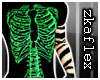 (ZF) RadioActive Zkll