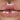 !CsSupport